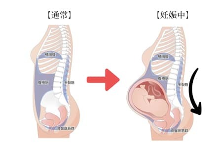 妊娠後の身体の変化。反り腰